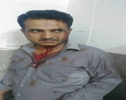 صنعاء..  طبيب يتعرض لاعتداء وحشي من قبل مليشيات الحوثي (صورة)
