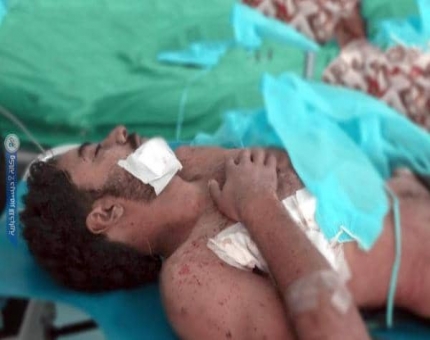 الحديدة.. مليشيات الحوثي تستهدف شاحنة نقل تجارية في التحيتا وتصيب سائقها