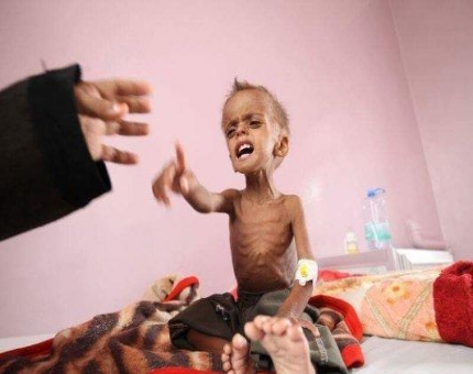 منظمة الأمم المتحدة للطفولة (يونيسف): وفاة أم و6 مواليد باليمن كل ساعتين