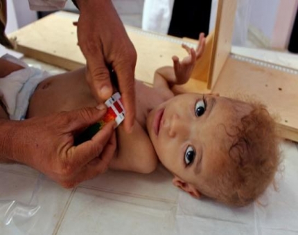 10 آلاف حالة اشتباه بالكوليرا في اليمن