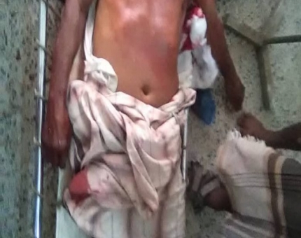 مقتل مواطن وجرح آخر إثر قصف مليشيات الحوثي على مديرية حيس بالحديدة