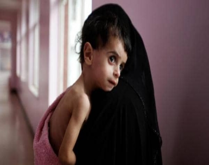 مليشيات الحوثي تصادر مساعدات مخصصة لمرضى سوء التغذية