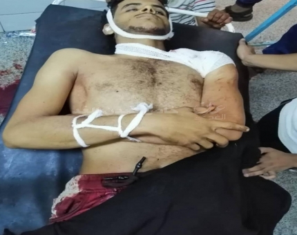 مقتل شابة بطريقة مأساوية في عدن