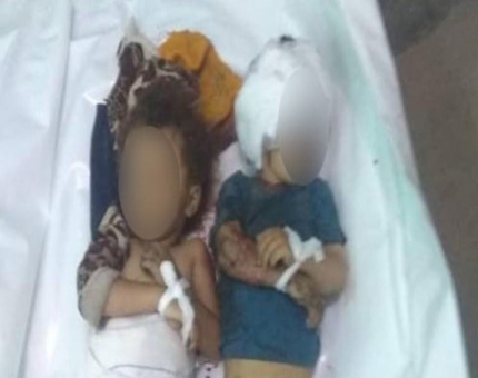 جريمة مروعة.. مقتل طفلين جراء قصف حوثي على تعز